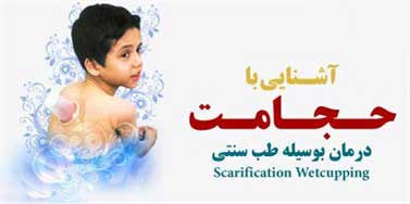 حلول ماه حزیران و حجامت / توجه ویژه رهبر به احیاء طب سنتی